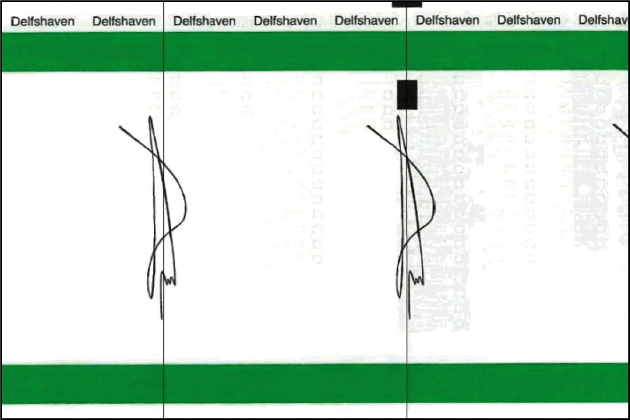 Twee groene kleurenbalken (boven en onderzijde – achterkant stembiljet)
